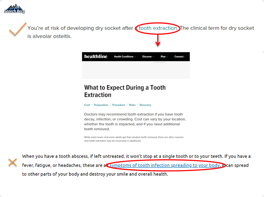 two screenshots showing examples of a good and bad anchor text in dentistry web content