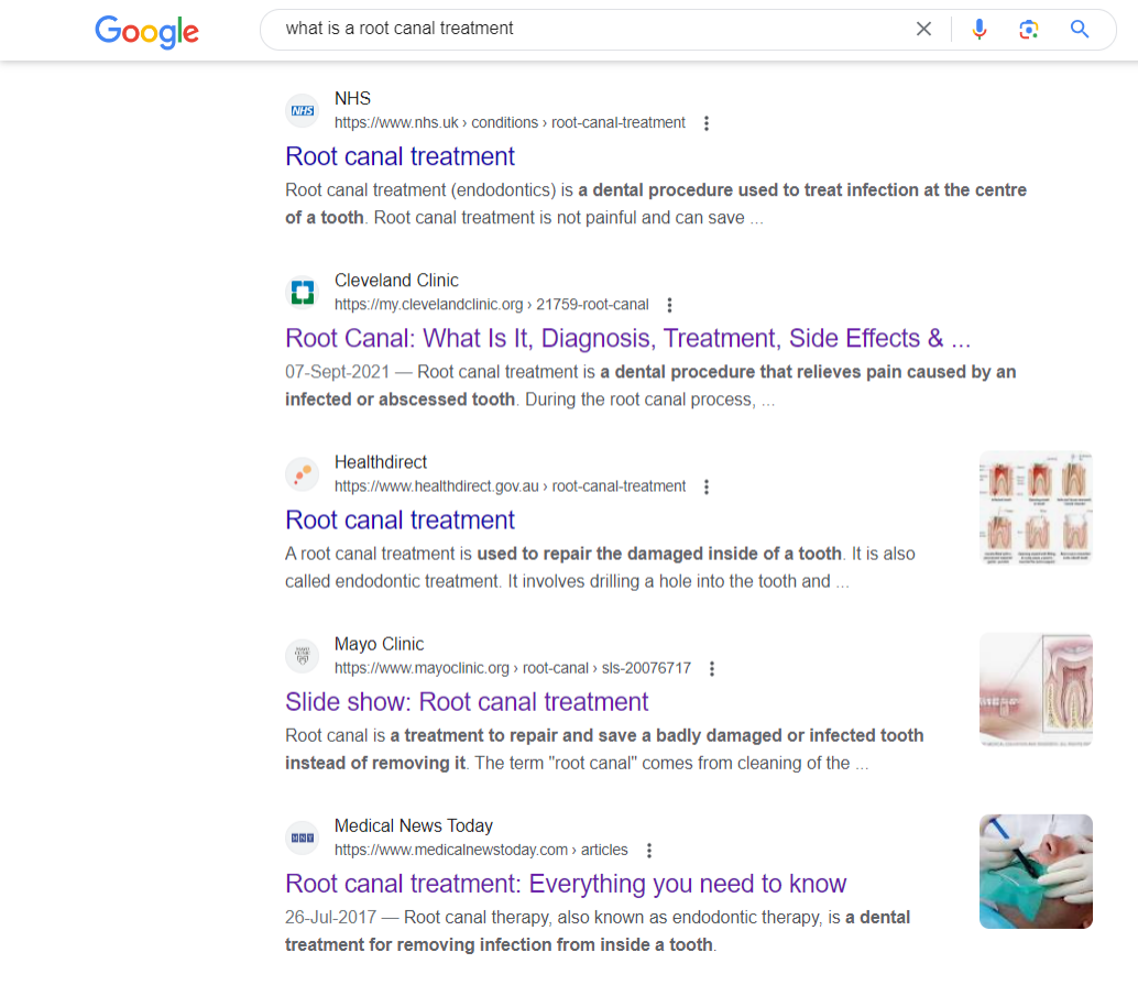 A Google search query and top results about root canal treatments