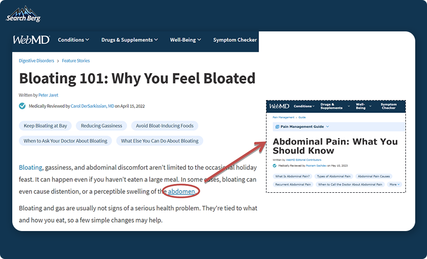 a screenshot of anchor texts on a WebMD webpage about bloating